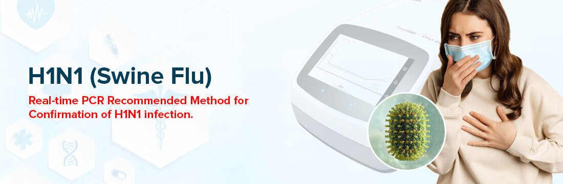 H1N1 (Swine Flu Virus): Real-Time PCR Recommended Method for Confirmation of Infection